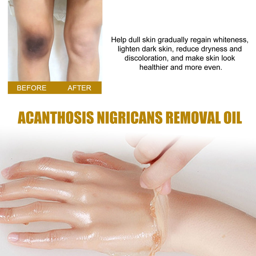 bottle of treatment oil for darkened skin areas