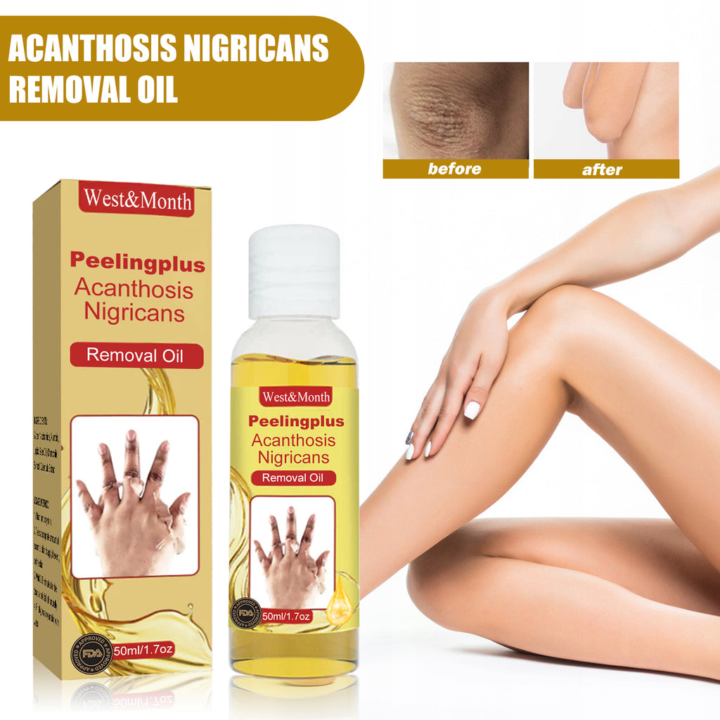 bottle of treatment oil for darkened skin areas
